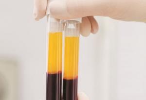 Global Platelet Rich Plasma (PRP) Market